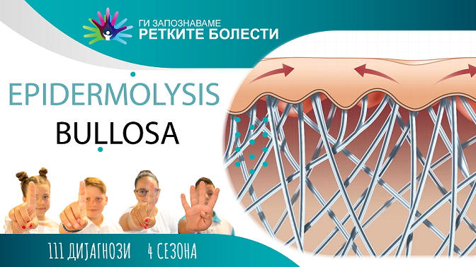 Ги запознаваме ретките болести: Булозна епидермолиза