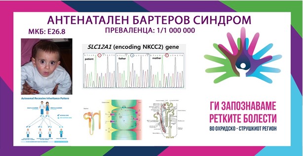 Ги запознаваме ретките болести во охридско – струшкиот регион: Антенатален Бартеров синдром